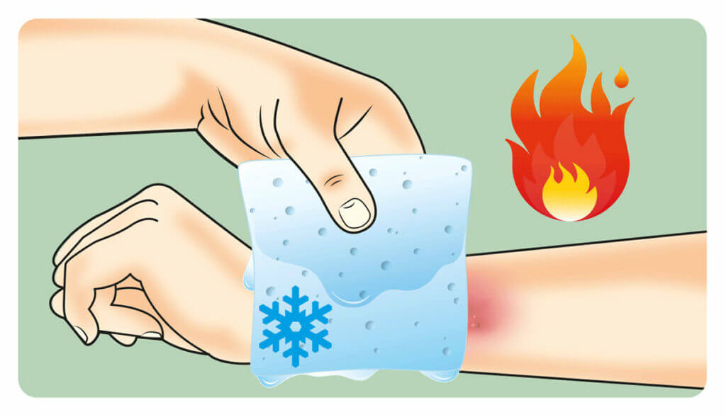Burn in Nawada Central Hospital